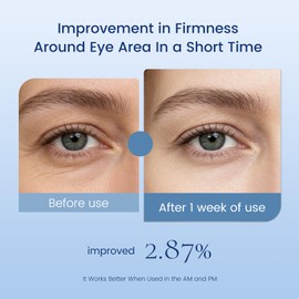 Eye Cream with Retinol for Anti Aging,1FlOz