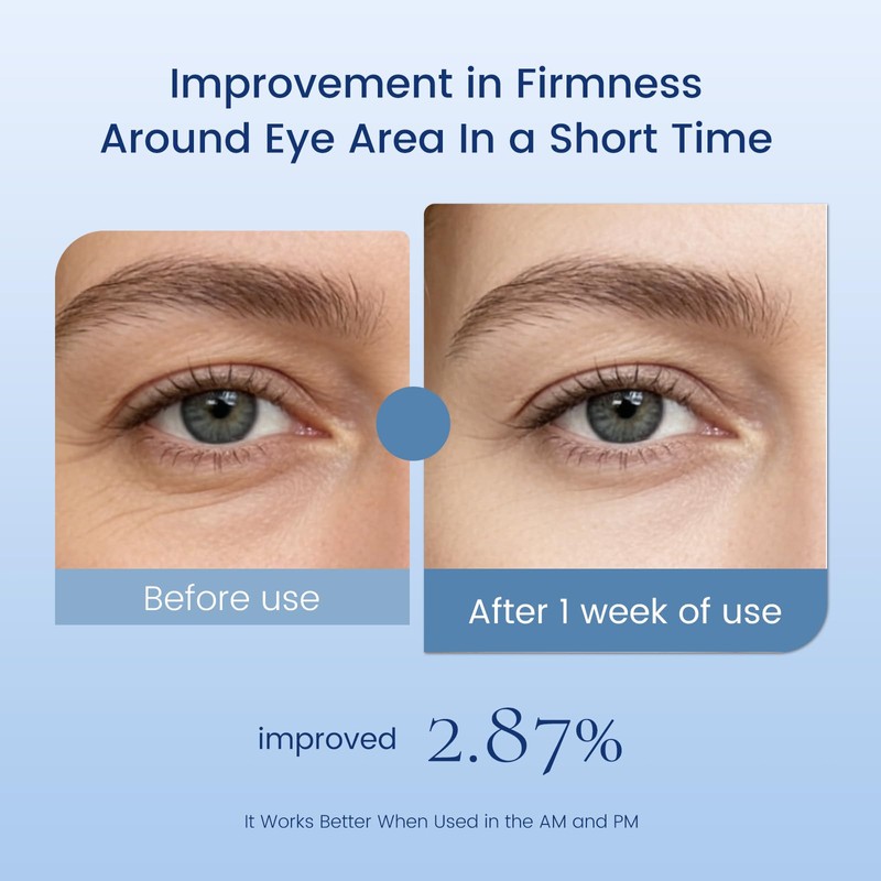 Eye Cream with Retinol for Anti Aging,1FlOz