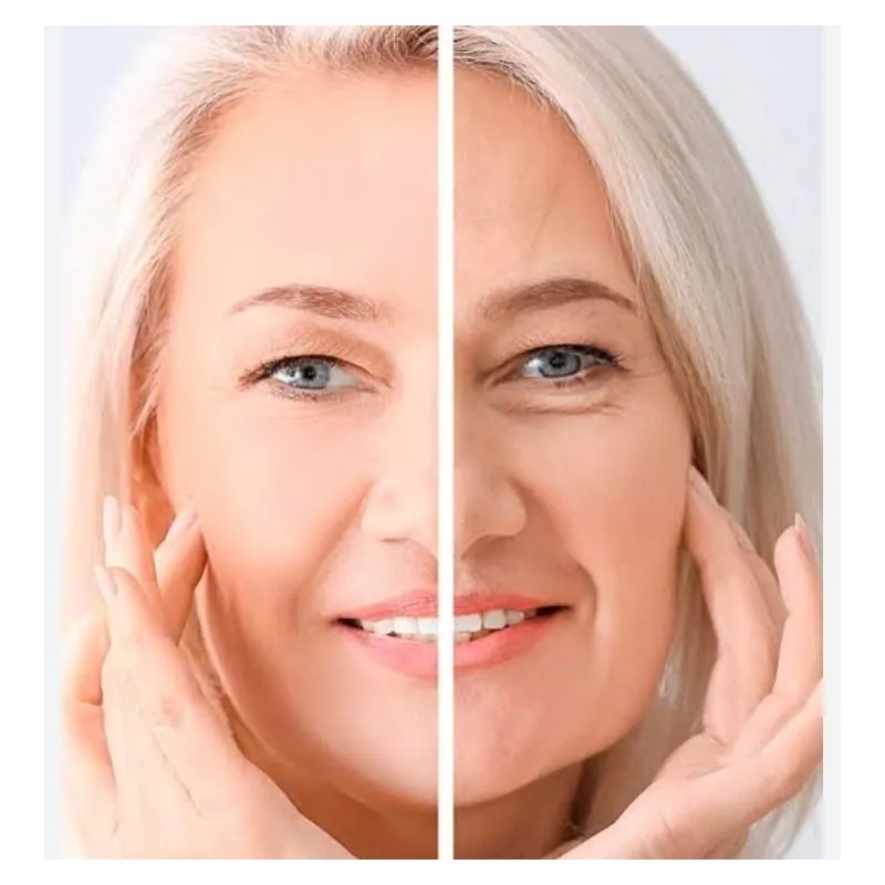 Tonico Serum Reafirmante Facial Antiarruga Ojera Savila 30m Mixta Delicada