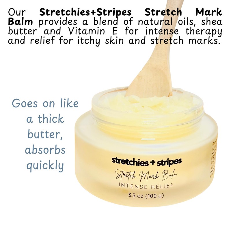 Momstead Stretchies and Stripes Stretch Mark Balm | Intense Relief