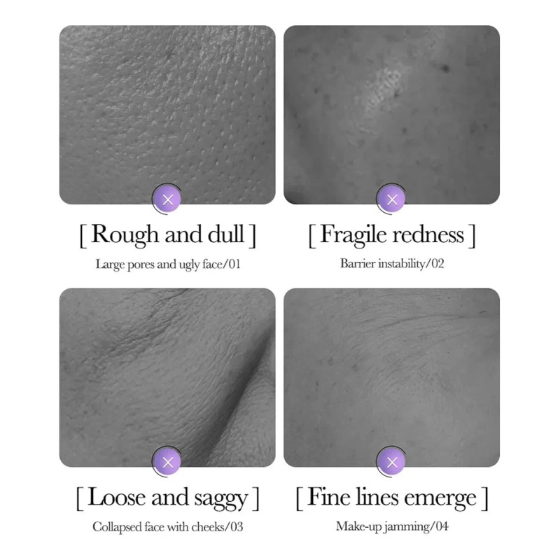 Set Cuidado De La Piel Vitamina C Retinol Y Acido