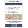THE Square Bottle Remover, Tweezers, General Medical Devices, Square Plug,