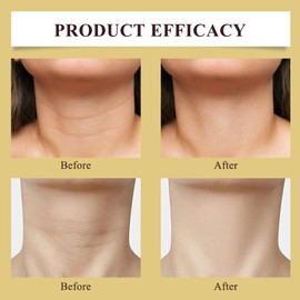 KUIRUNRX® Firming Neck Cream, Natürlich Halsstraffungscreme und Gegen Falten mit Roller, Straffende Creme Halscreme zur Reduzierung von Falten, Halslinien und Schlaffer Haut, 120g