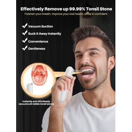 Voraiya Tonsil Stone Remover, Electronic Vacuum 10 in 1 Tonsil Stone Removal Kit, 5 Modes Cleaner, Oral lamp & 5X Magnifying Mirror Included, Tonsil Cleaner, Fight Bad Breath, Oral Care (White)