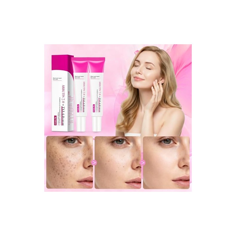 Txa Cream Crema Manchas Faciales Cremas Aclaramiento Piel Oscuras Pecas