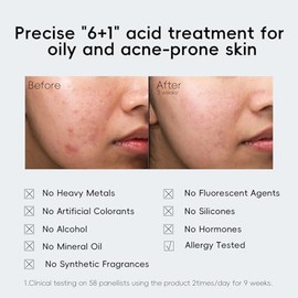 Resurface Face Exfoliant Serum - Suero de ácido láctico, ácido azelaico, ácido salicílico, niacinamida-para acné/piel sensible, piel lisa, piel rejuvenecida 4D, viales antifatiga-30 de un solo uso