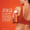Aceite Bio-oil Para Cicatrices Y Estrías Con Vitaminas A Y