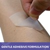 Conkote Transparent Medical Tape 1" x 10 Yards, First Aid