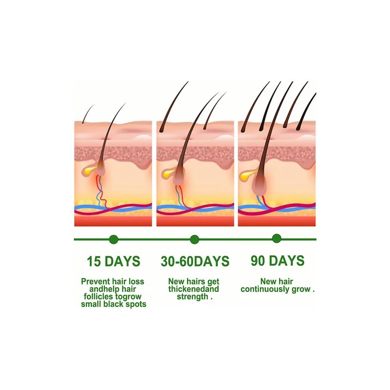 Sérum Capilar con Aceite de Romero 30ml – Crecimiento, Fortalecimiento