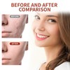 Xumann 2PCS Collagen Peel Off Mask for Elasticity Hydration Care