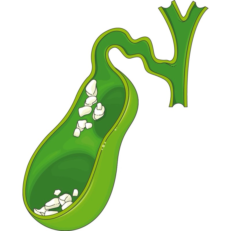 Bio Life CHANCA PIEDRA PARA LOS CALCULOS Y MAS