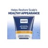 Shampoo Terapéutico Psoriasis Mg217 240ml Alquitrán Carbon