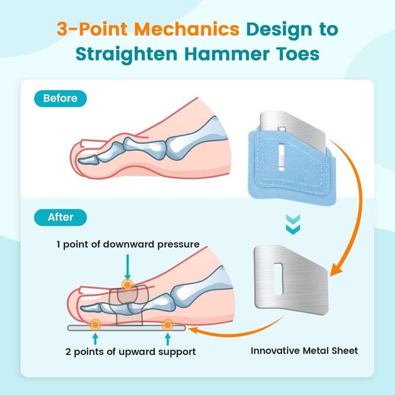 Pozpo Tech Hammer Toe Straightener Corrector Splint Brace for Women