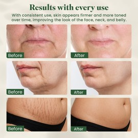 Eden & Elm - Face and Neck Lifting Red Light Massager, Full Body Lymphatic Drainage Massager, Targets The Appearance of Wrinkles & Stretch Marks, Compact 7-Colors Wireless Beauty Tool