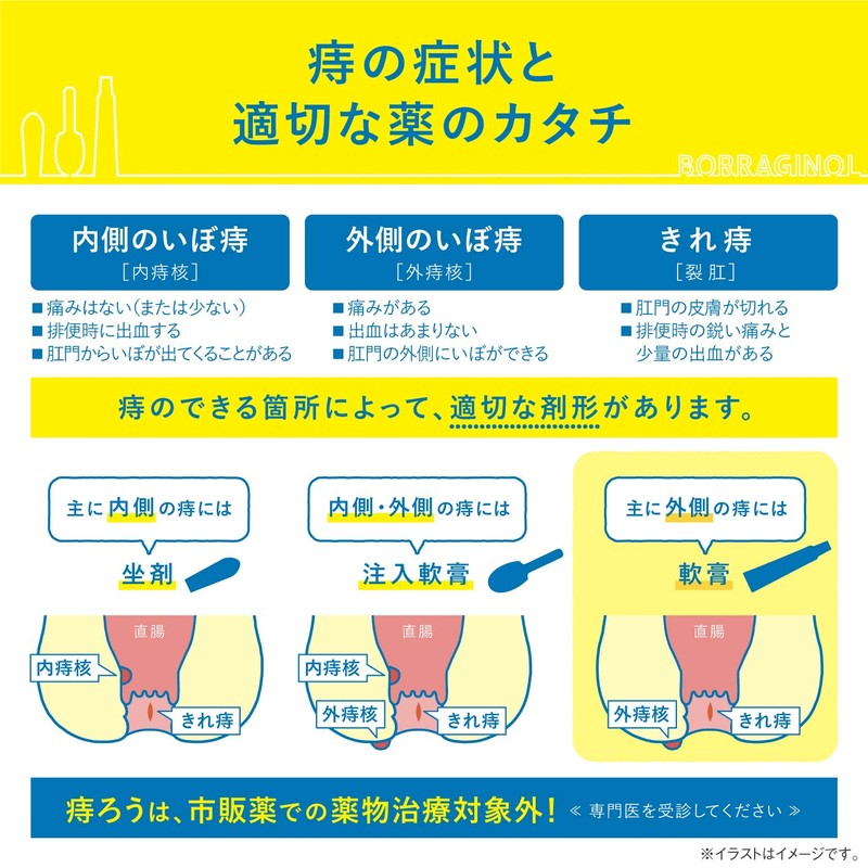 【指定第2類医薬品】ボラギノールA軟膏 20g