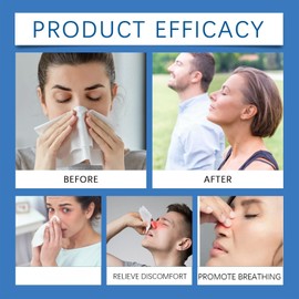 Nasal Moisturizer,Nasal Cream,Nasal Gel for Dry Nose,Non Irritating Gentle Safe Dry Nose,Natural & Safe Soothing Nasal Cream,Nasal Cream for Dry Nose Relief,Hydrating Mild Acting Nasal Cream