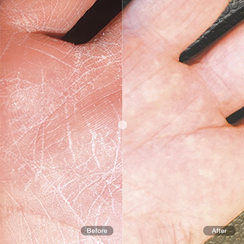 DU'IT Tough Hands, 5.1 Fluid Ounce