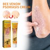 Wellness South Moon Anti-Itch Bee Venom Psoriasis Cream Cooling Soothing