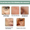 Bluemega Esencia Advanced Collagen Boosting Anti-aging Serum