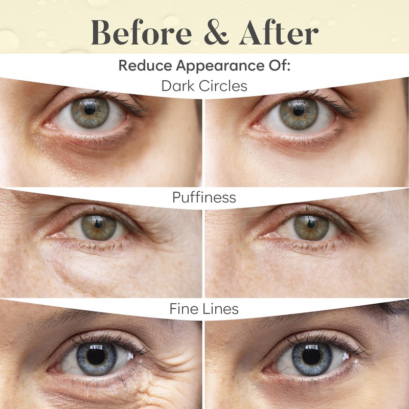 AURAE 24K Gold Under Eye Gel Patches (30 Pairs) -