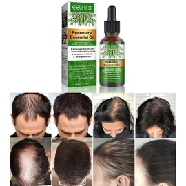 Aceite Natural de Romero para la Caída del Cabello Aceite de Romero para el Crecimiento del Cabello, Dañado Estimula el Crecimiento del Cabello Cuida el Cuero Cabelludo Seco