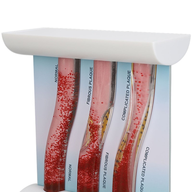 Lipoprotein LDL Blood Vessel Model Low Density Blood Lipid Vessel