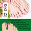 JAYSUING Ginger Nail Treatment Nail Support Nail Care, 7days Nail