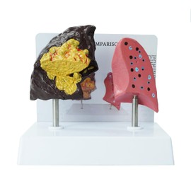 YANHAO Smokers Lung Model + Healthy Lung Model Life Size Human Lung Anatomy Model with Pathological Features and Accurate Anatomy Structure for Emonstrate The Effects of Smoking on Lung Health