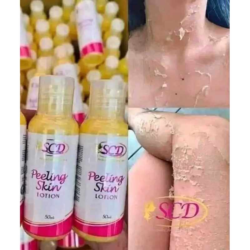 SCD Skin Peeling Lotion 100ml Bottle (beautyvault🇺