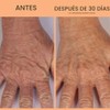 Crpe Erase Advanced Anti Aging Hand Repair Treatment with TruFirm