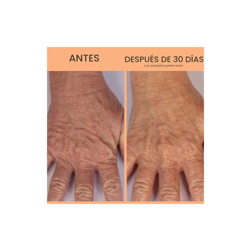 Crpe Erase Advanced Anti Aging Hand Repair Treatment with TruFirm