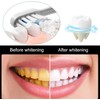 Sp10 Probiotic Ultra Whitening Toothpaste (3 Pack)