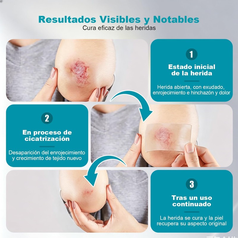 Cinta Hydrocolloid Roll 3m x 2PCS, Vendajes de Parches Hidrocoloides