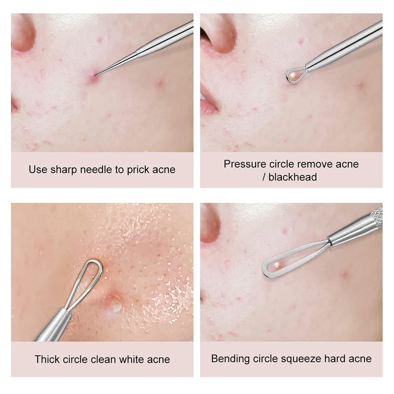 La chat Pimple Extractor Tools, Blackhead Remover, Pimple Popper, Acne