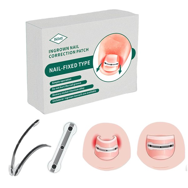 Ingrown Toenail Removal Kit | Titanium Alloy Ingrown Toenail Treatment