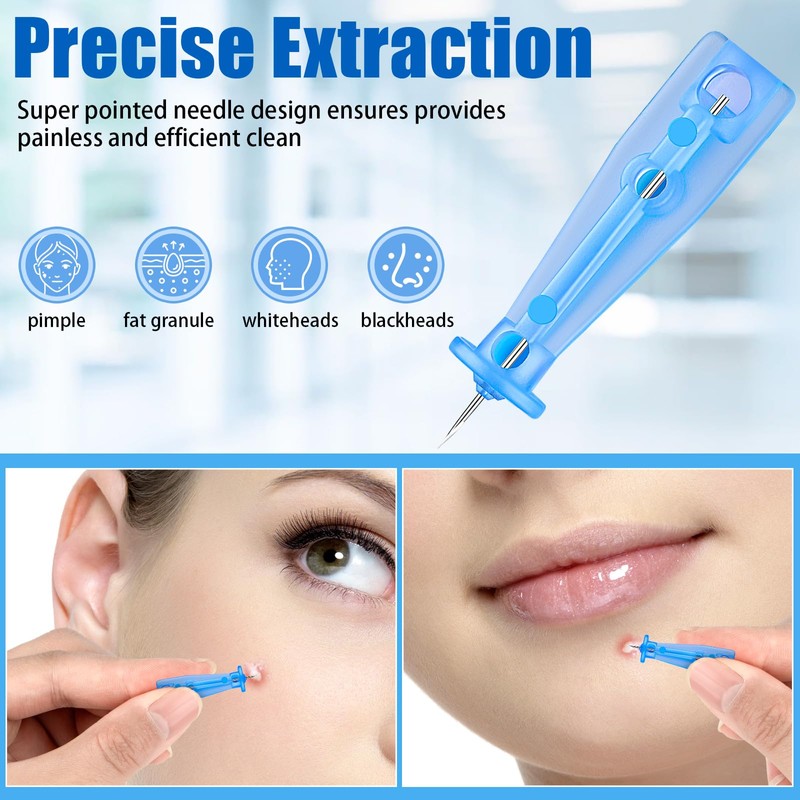 200Pcs Sterile Needles for Pimples, Disposable Acne Needle Effective Blemish