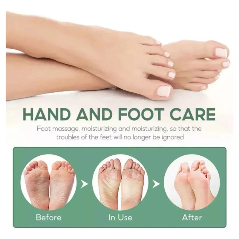Ff@ La Aj Crema De Urea Al 40% 2% De