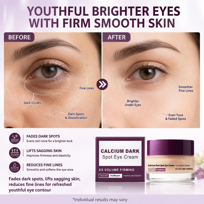 3/4PCS Calcium Dark Spot Cover Eye Cream 15g – Niacinamide