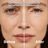 Darsonval Portable Handheld Skin Care Machine