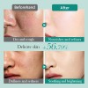 Set 6 En 1 Cuidado Facial Skincare Acido Hialuronico Bioaqua
