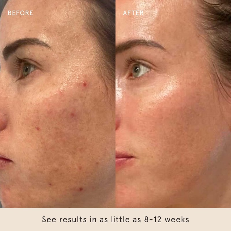 Barefaced Retinal Skin Therapy 30ml - Retinaldehyde & Bakuchiol Serum