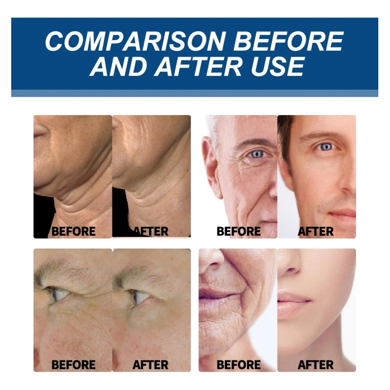 Ee Crema Retinol Anti Aging Anti Edad Reafirmante, Dia Noche