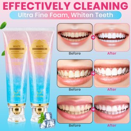 2Pcs Niacinamide Whitening Toothpaste Radiant Whitening Toothpaste, Niacinamide Intensive White Toothpastes, Nicotinamide White Toothpastes, Deep Cleaning Care