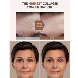 Zenbora 8PCS Bio-Collagen Face Mask, Deep Collagen Anti-Wrinkle Lifting Mask, Real Deep Hydrating Overnight Facial Sheet/Firming Sleeping Mask