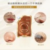 [In Stock] Blackhead and Acne Removal Mask - Lightens Dark
