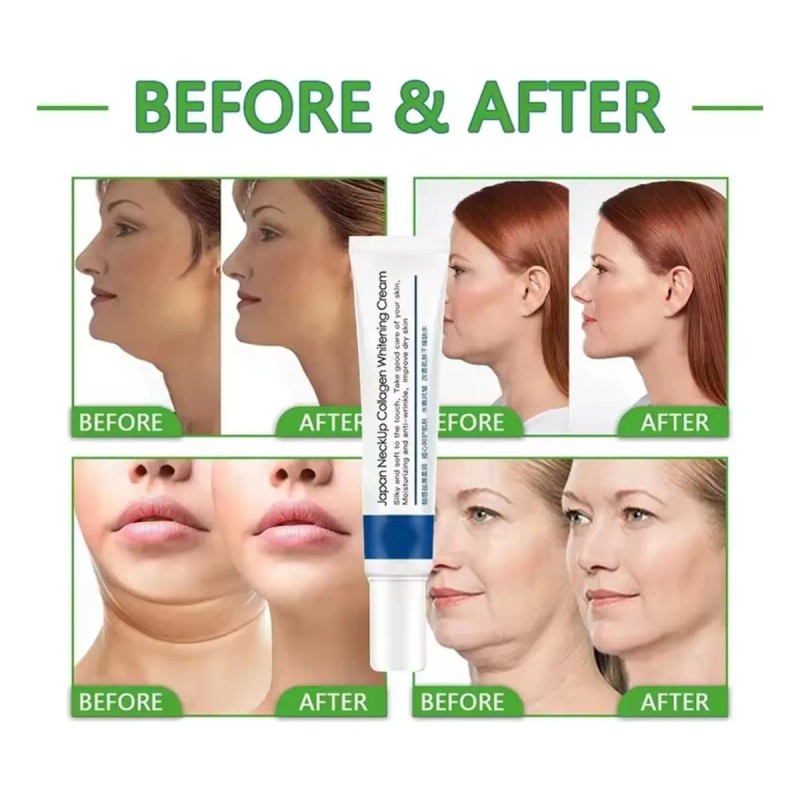 Crema Colágeno Cuello Papada Antiedad Reafirmante Antiarruga Todo Tipo De