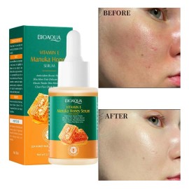 Serum De Vitamina E Y Miel De Manuka Hidrata Da Brillo Momento De Aplicación Día/noche Tipo De Piel Todo Tipo De Piel