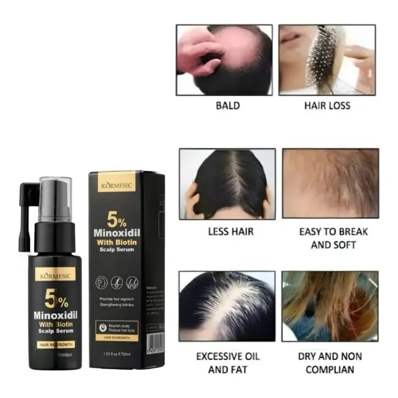 Monoxidil 5% Y Biotina Tratamiento Calvicie Crecer Cabello