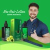 Original Neo Hair Lotion 120ml With Derma Roller Effective Hair