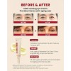 2pcs Ksecret Seúl 1988 Crema De Ojos Antiedad 4% Retinal30ml